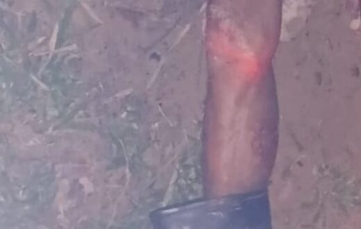 Polícia apura morte de idoso encontrado com marcas de mordidas em flutuante de Manaus