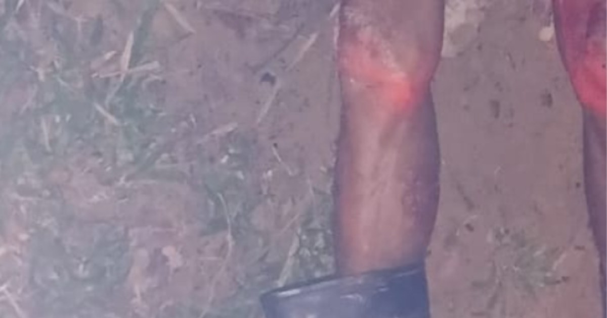 Polícia apura morte de idoso encontrado com marcas de mordidas em flutuante de Manaus